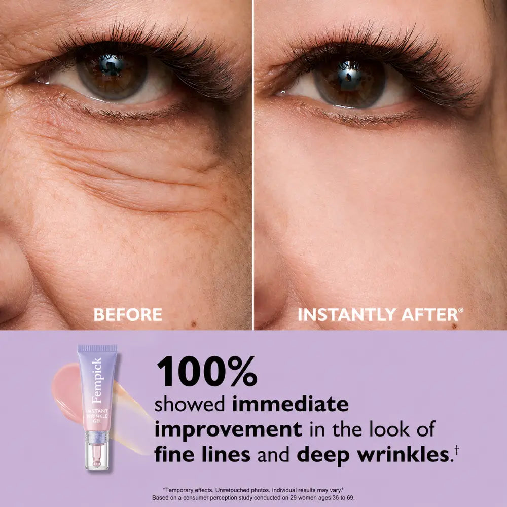 Fempick Eye Bag Instant Eraser, Tightens, Firms, & Blurs Wrinkles