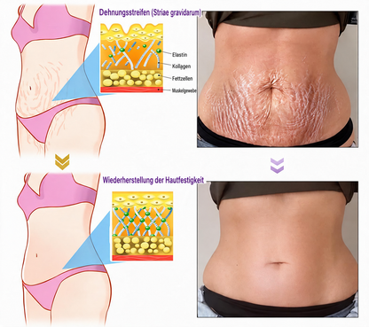 Natravor®🎗️ PDRN Multi-Peptid Straffende Körpercreme ｜ Anti-Aging Pflege, Feuchtigkeit, Straffung & Lifting für ein glatteres, ebenmäßigeres Hautbild