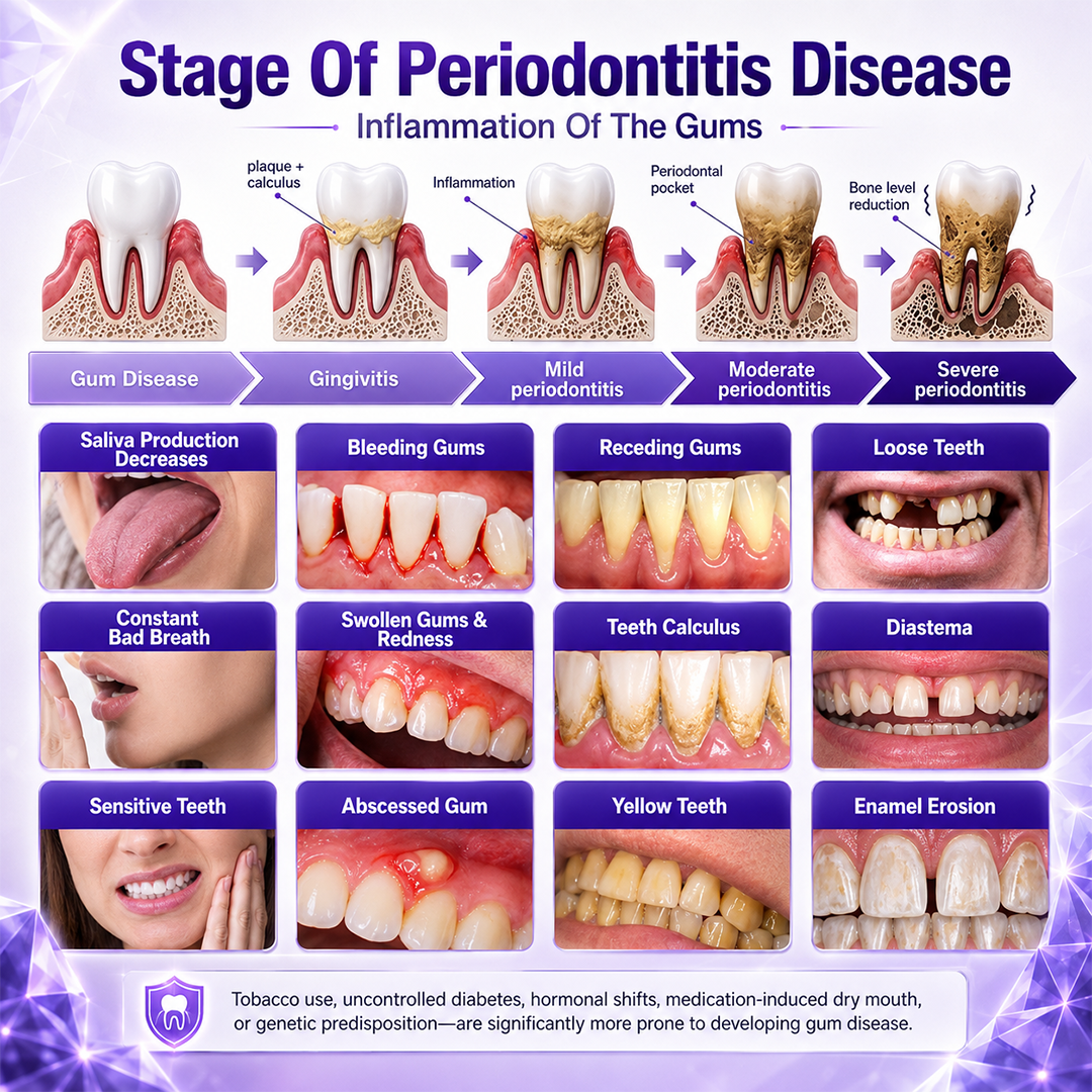 Borsyn® Gingivitis Periodontal Treatment Toothpaste