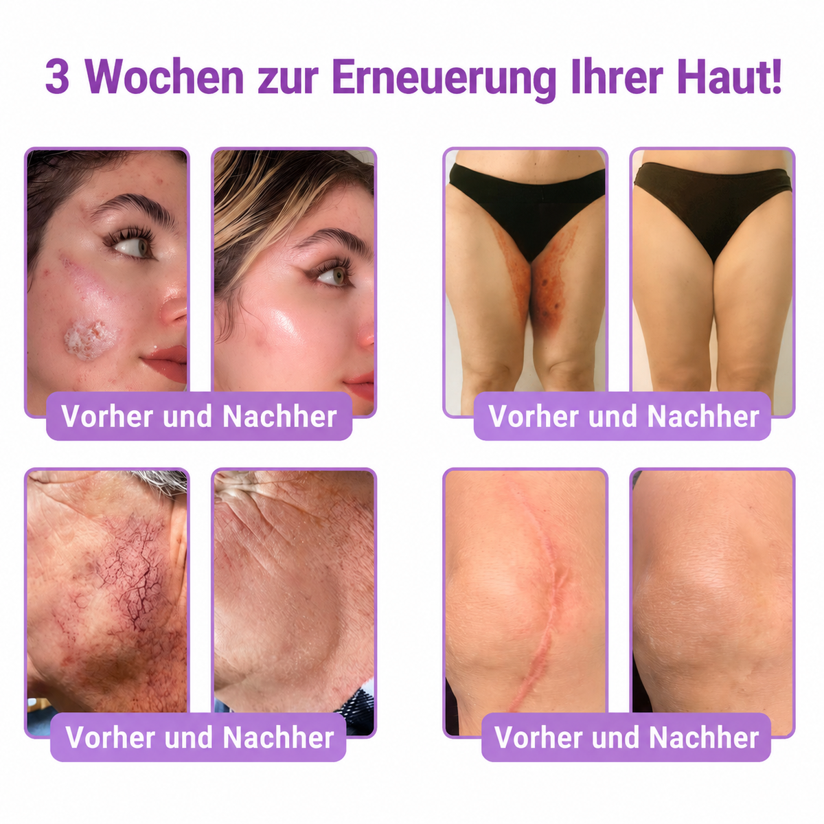 Natravor®🎗️ PDRN Multi-Peptid Straffende Körpercreme ｜ Anti-Aging Pflege, Feuchtigkeit, Straffung & Lifting für ein glatteres, ebenmäßigeres Hautbild
