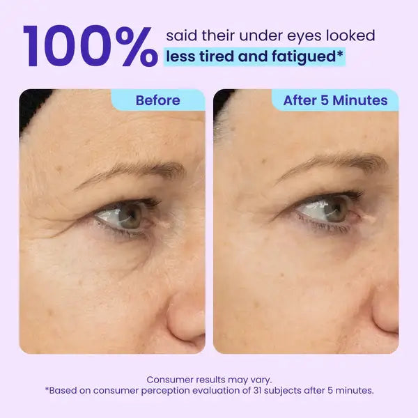 Fempick Eye Bag Instant Eraser, Tightens, Firms, & Blurs Wrinkles