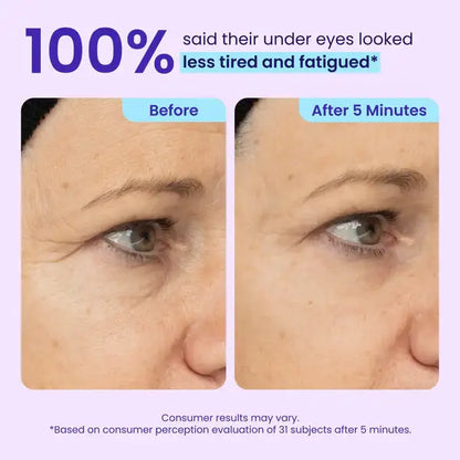 Fempick Eye Bag Instant Eraser, Tightens, Firms, & Blurs Wrinkles