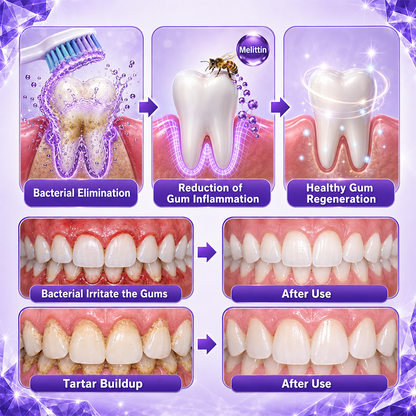 Borsyn® Gingivitis Periodontal Treatment Toothpaste