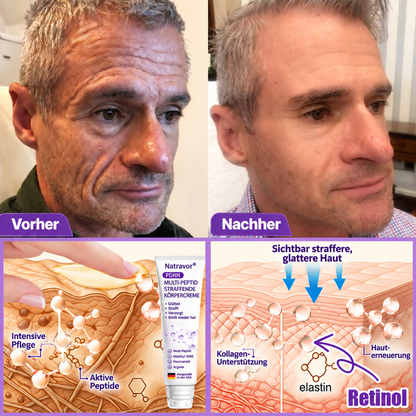 Natravor®🎗️ PDRN Multi-Peptid Straffende Körpercreme ｜ Anti-Aging Pflege, Feuchtigkeit, Straffung & Lifting für ein glatteres, ebenmäßigeres Hautbild
