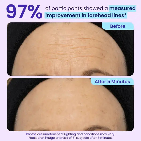 Fempick Eye Bag Instant Eraser, Tightens, Firms, & Blurs Wrinkles