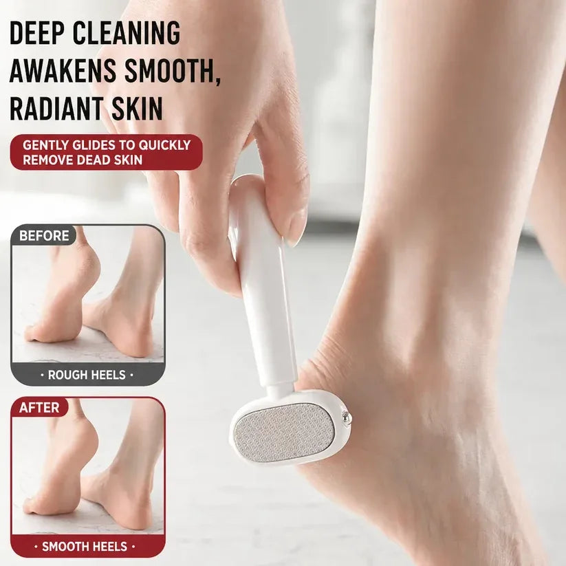 🦶 Avelynis 2-in-1 Callus Remover | Get Sandal-Ready Feet Without the Salon