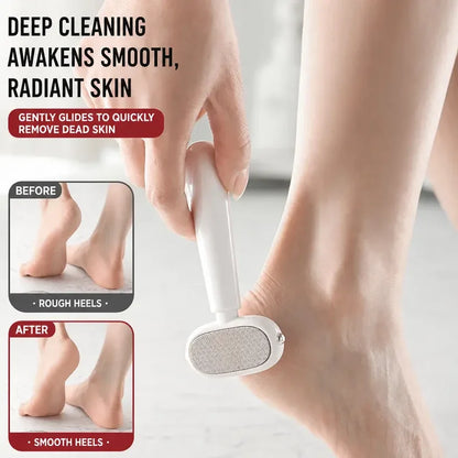 🦶 Avelynis 2-in-1 Callus Remover | Get Sandal-Ready Feet Without the Salon