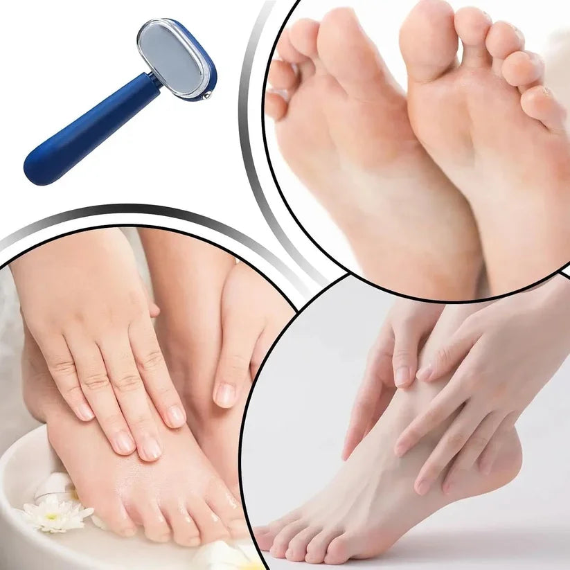 🦶 Avelynis 2-in-1 Callus Remover | Get Sandal-Ready Feet Without the Salon